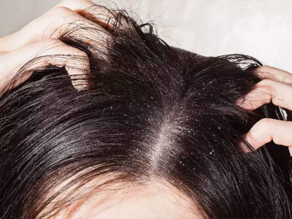 ड्रैंडफ