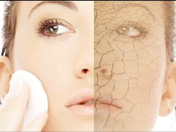 रूखी त्वचा