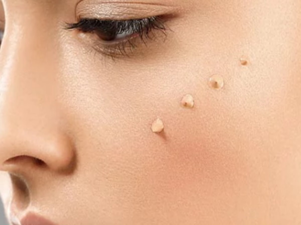 फाउंडेशन क्या होता है