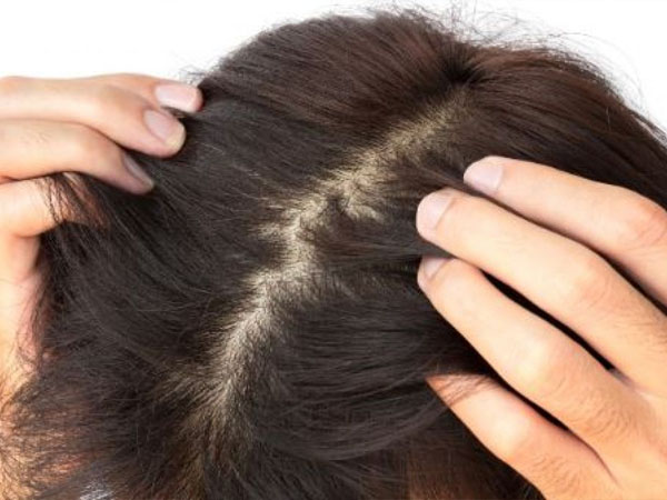बालों की जड़े मजबूत 