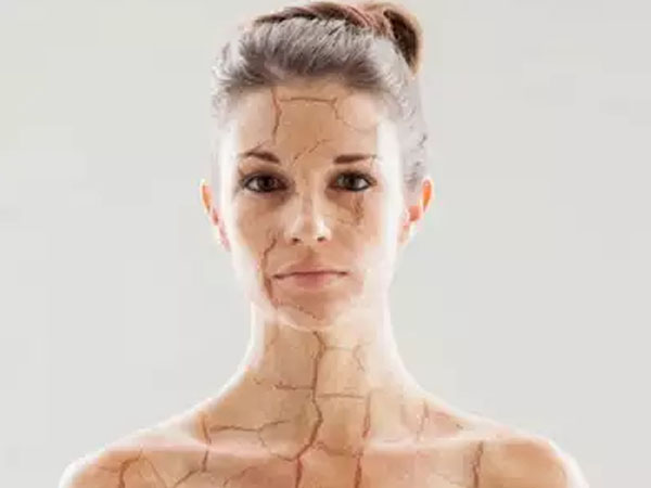 ड्राई स्किन