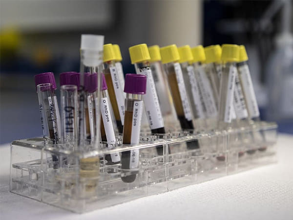 ये होगा फायदा