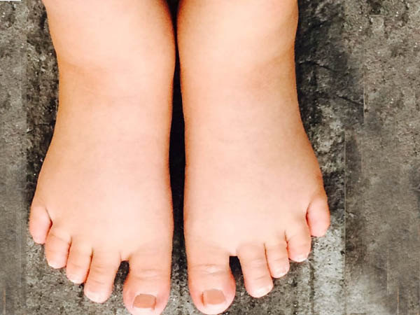 गर्भाशय का बढ़ना