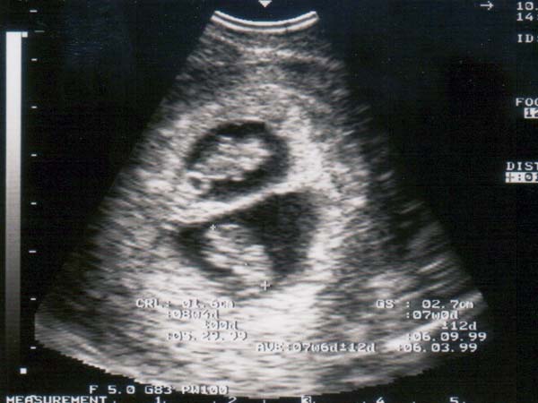 येम फल का उपयोग