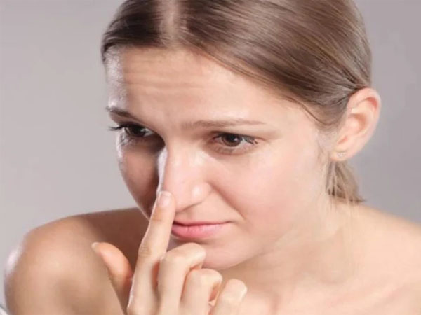 ब्लैकहेड्स