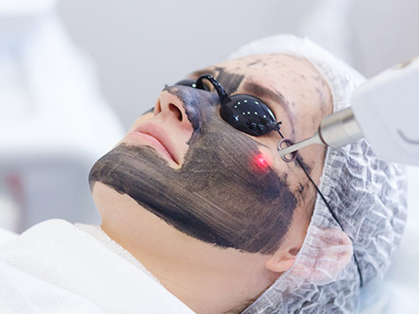 Carbon Laser Facial Carbon Laser Facial