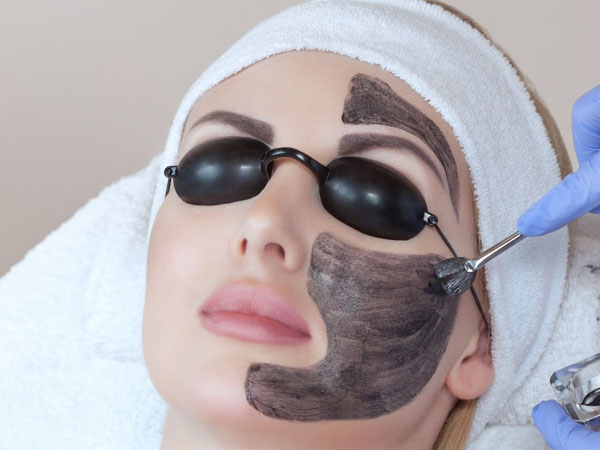 क्यों करवाना चाहिए कार्बन फेशियल क्यों करवाना चाहिए कार्बन फेशियल