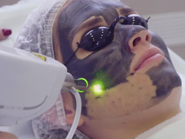 कार्बन फेशियल साइड इफेक्ट कार्बन फेशियल साइड इफेक्ट