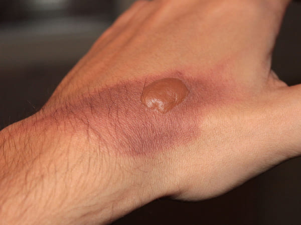 ठंडे पानी से रहें दूर