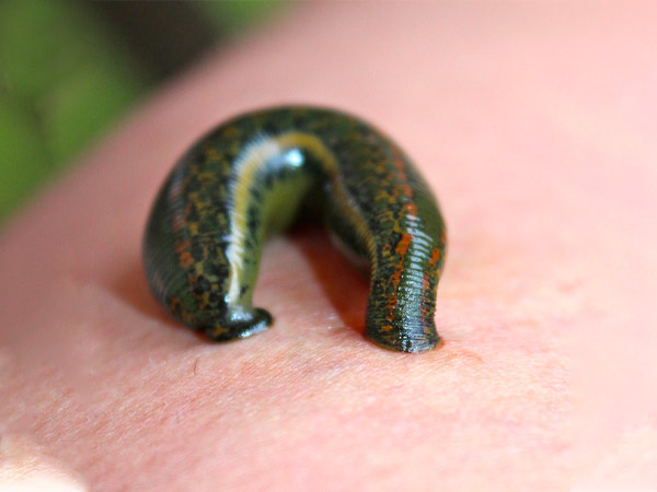  लीच थेरेपी