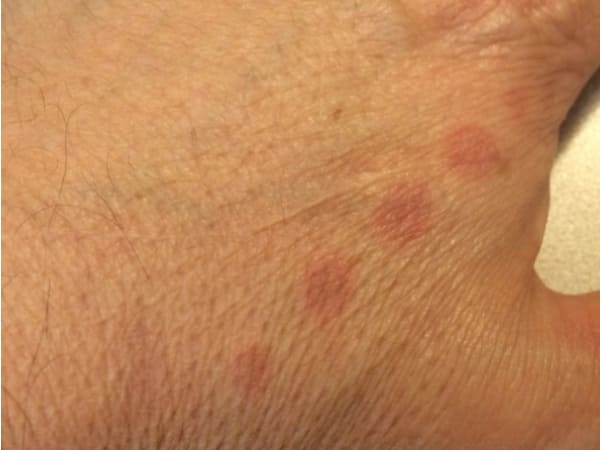 न लगाए मरहम