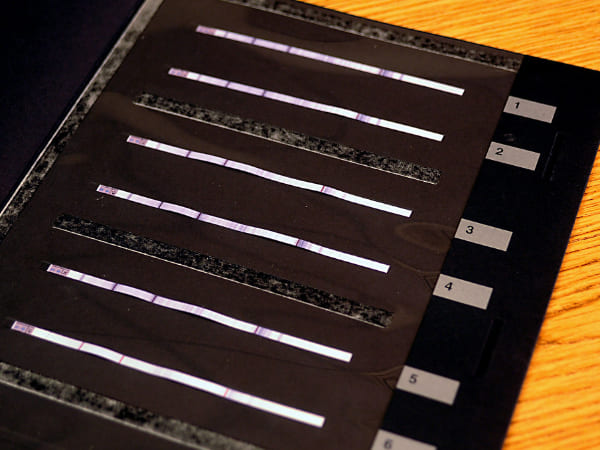 नेगेटिव और पॉज‍िट‍िव र‍िपोर्ट आने पर जानें क्‍या करते हैं?