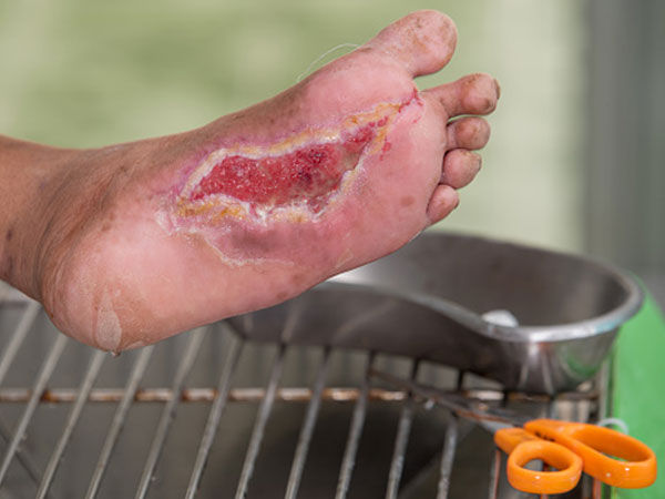 इन बातों का रखें ध्‍यान 