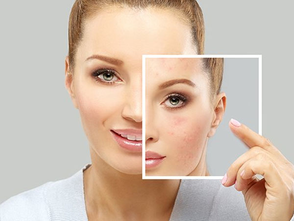 क्लीन फेस