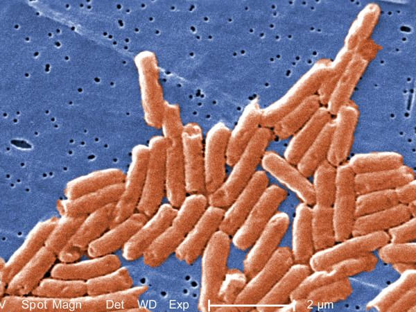 Red onions linked to salmonella outbreak in US