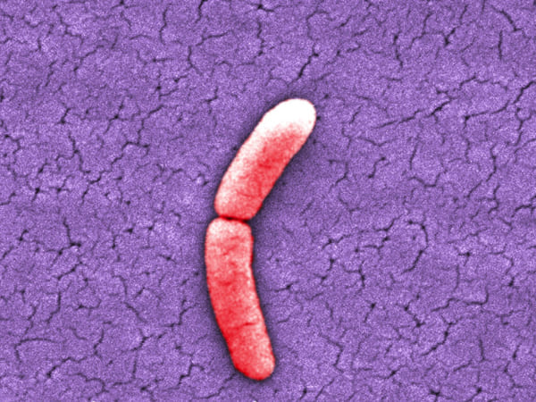 Red onions linked to salmonella outbreak in US