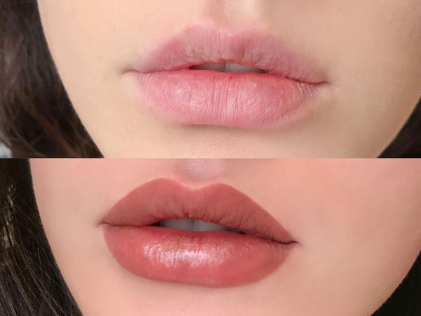 लिप टैटू या लिप फिलर्स से कैसे अलग है लिप ब्लशिंग