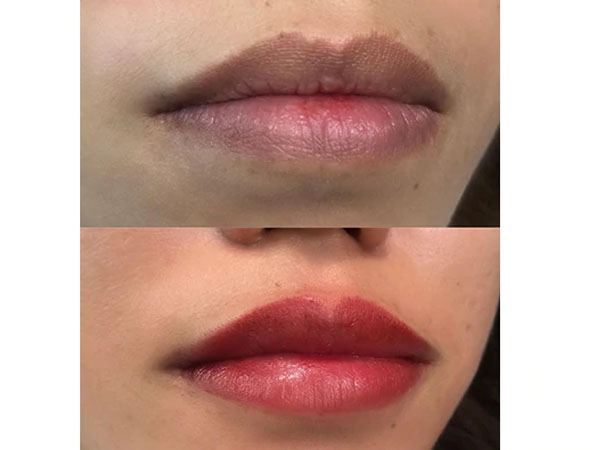 लिप ब्लशिंग कराने से पहले इन बातों का रखें ध्यान