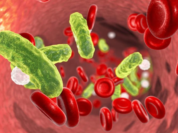 सेप्टिक शॉक के लक्षण-