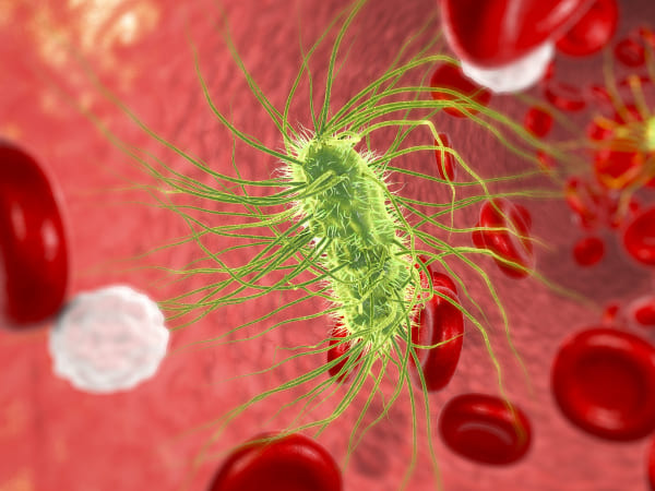 सेप्टिक शॉक से क्या हो सकता है