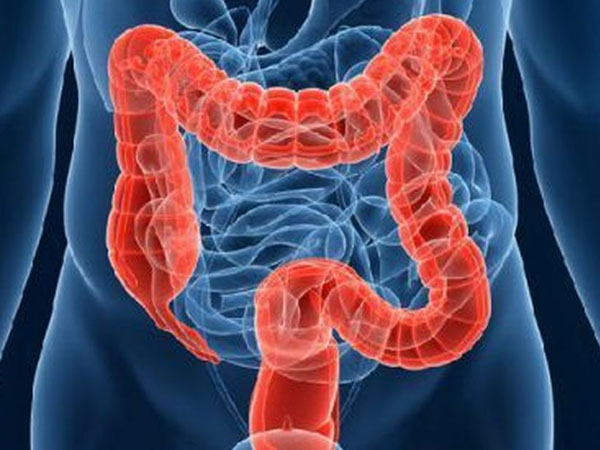 बड़ी आंत की सूजन