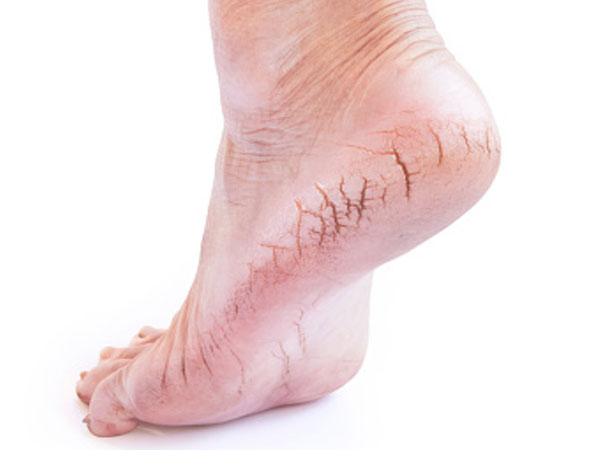 केले और दही फूट मास्क को यूज करने का तरीका