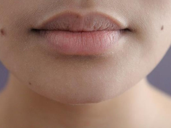 होठों का कालापन करें दूर