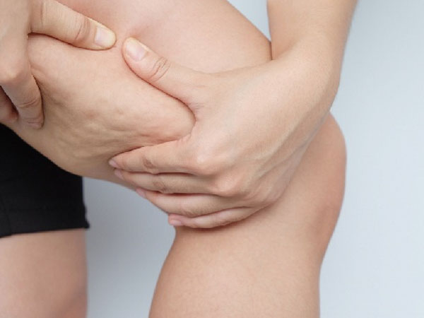 सेल्युलाईट स्किन