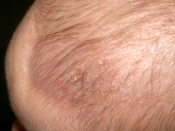 आते हैं यह लक्षण नजर