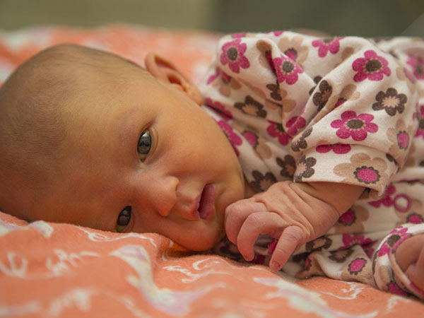 ब्रेस्ट मिल्क जॉन्डिस का कारण