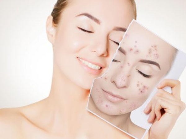 होममेड ब्लीच के फायदे