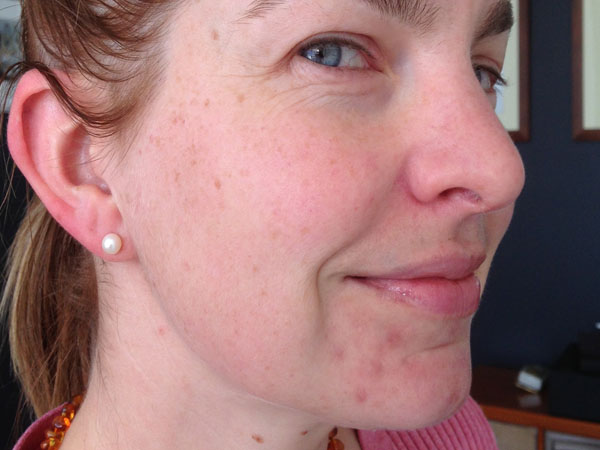 ठीक होने में कितना समय लगता है