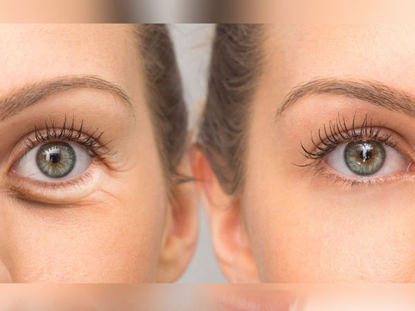 इन बातों का रखें खास ध्यान