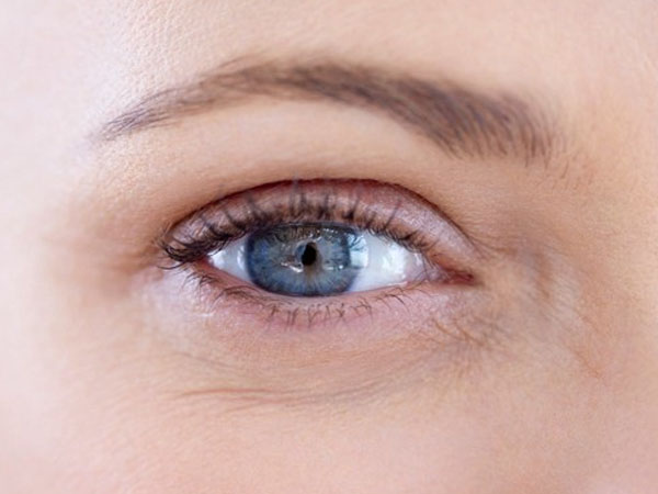 आंखों की झुर्रियां के कारण 