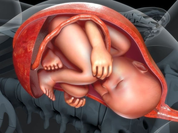 ब्रीच गर्भावस्था में होते हैं यह कॉम्पलीकेशन