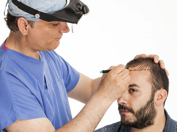 हेयर ट्रांसप्लांट क्या है