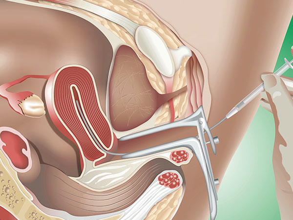 आईवीएफ और प्राकृतिक गर्भाधान