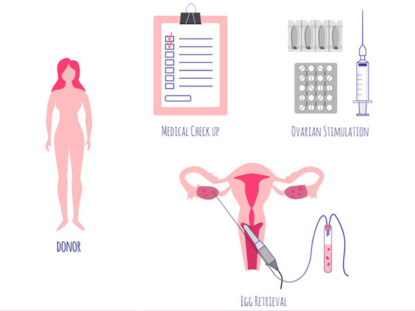 डोनर एग गर्भाधान