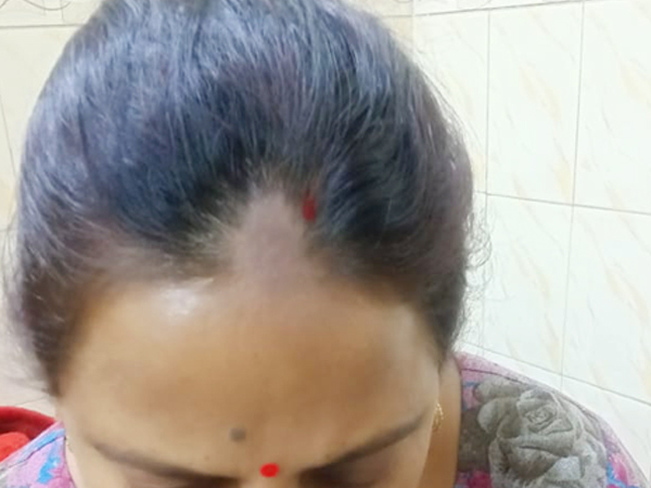 चुटकी भर सिंदूर बना सकता गंजा