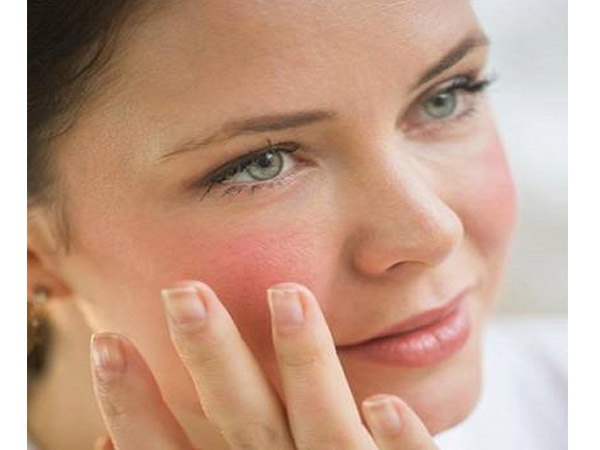 रेडनेस रेडनेस