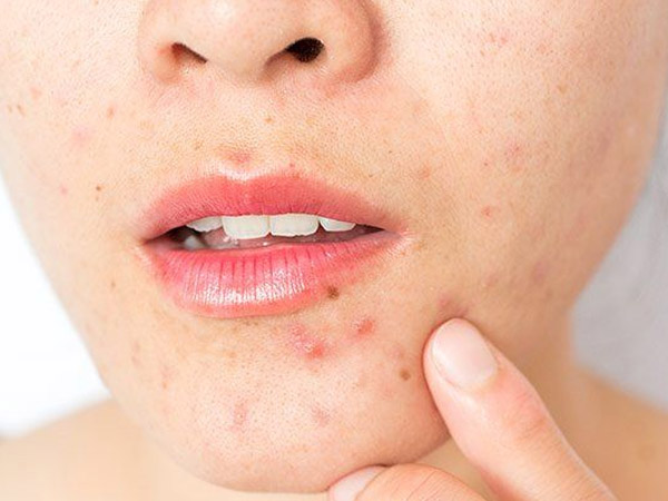 ब्रेकआउट ब्रेकआउट