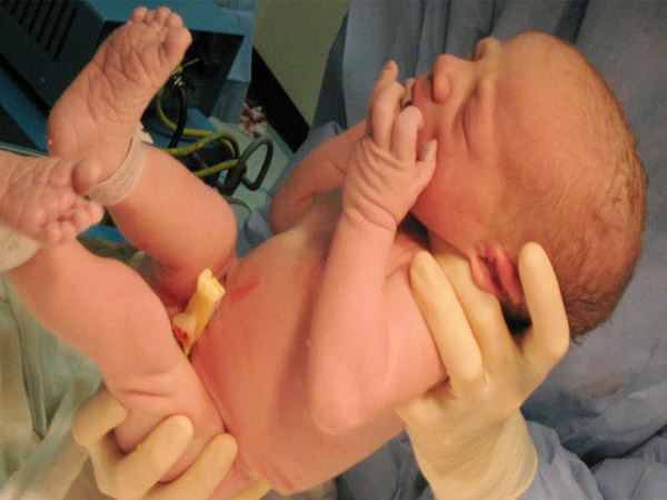 स्टेम सेल ट्रांसप्लांट के बाद गर्भावस्था मुश्किल क्यों है?