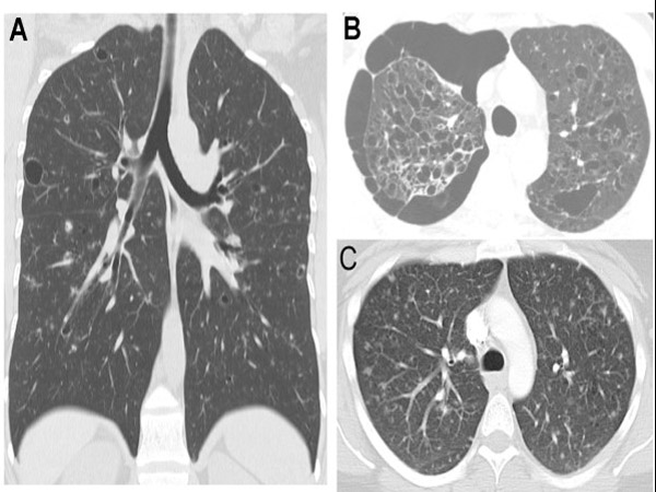 सिटी स्कैन टेस्ट