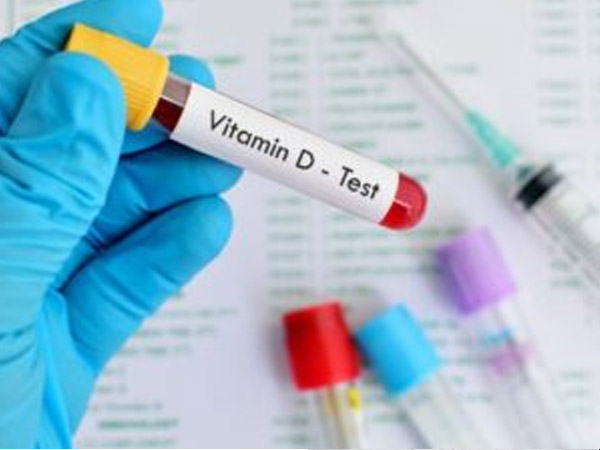 विटामिन डी टेस्ट