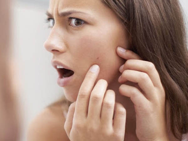 गर्मी में एक्ने के लिए लगाएं ये होममेड फेस पैक