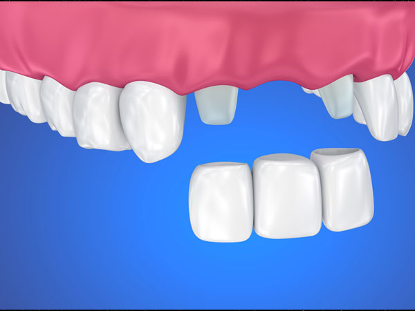 डेंटिस्ट के पास जाए