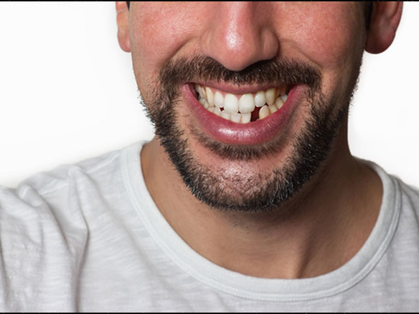 गर्म पानी से साफ करें