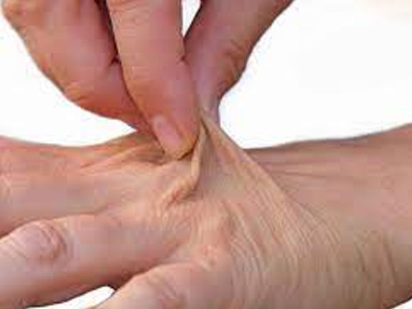 कैसे करें आसान डिहाइड्रेशन टेस्ट?