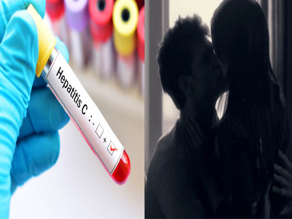 क्या ये यौन संचारित रोग है? क्या ये यौन संचारित रोग है?