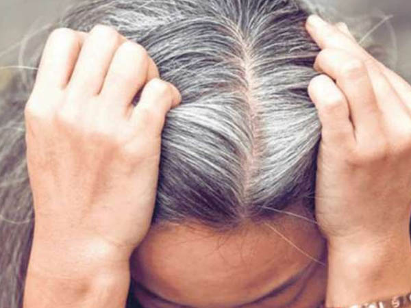 सफेद बालों की परेशानी